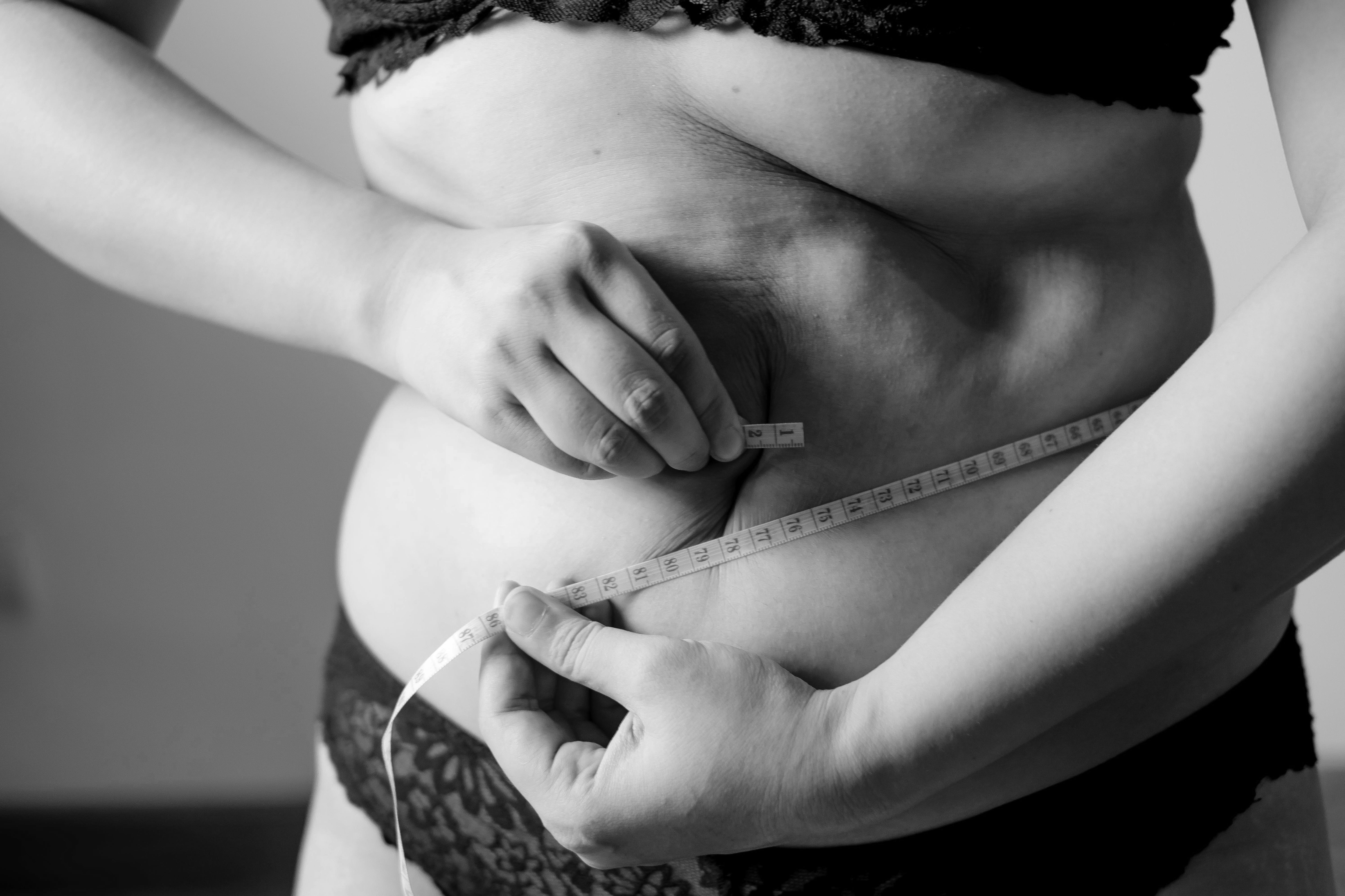 woman has belly fat with pcos